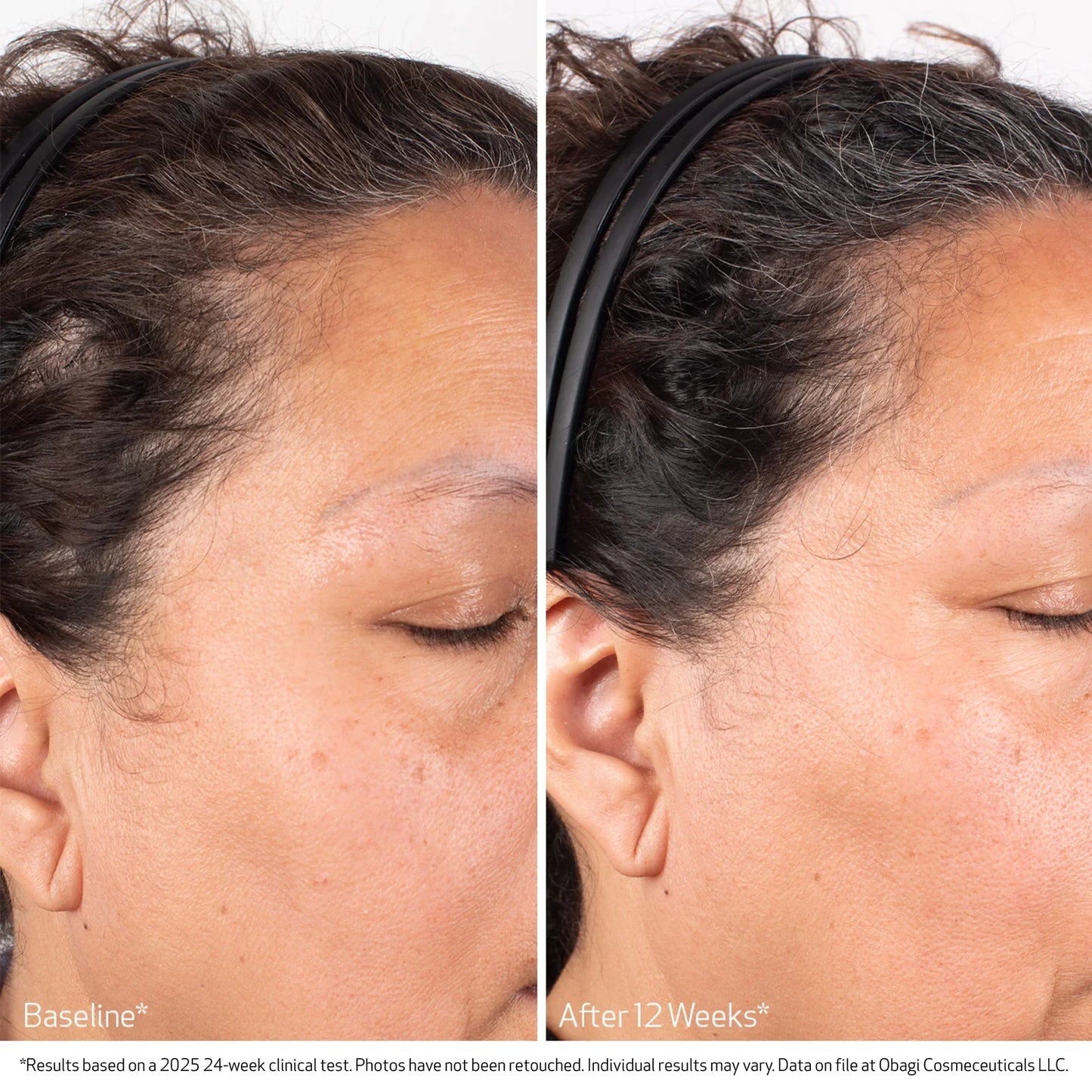 Obagi Nu-Cil Biostim™ Scalp Serum