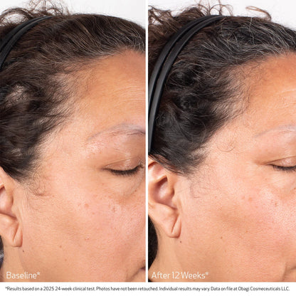 Obagi Nu-Cil Biostim™ Scalp Serum