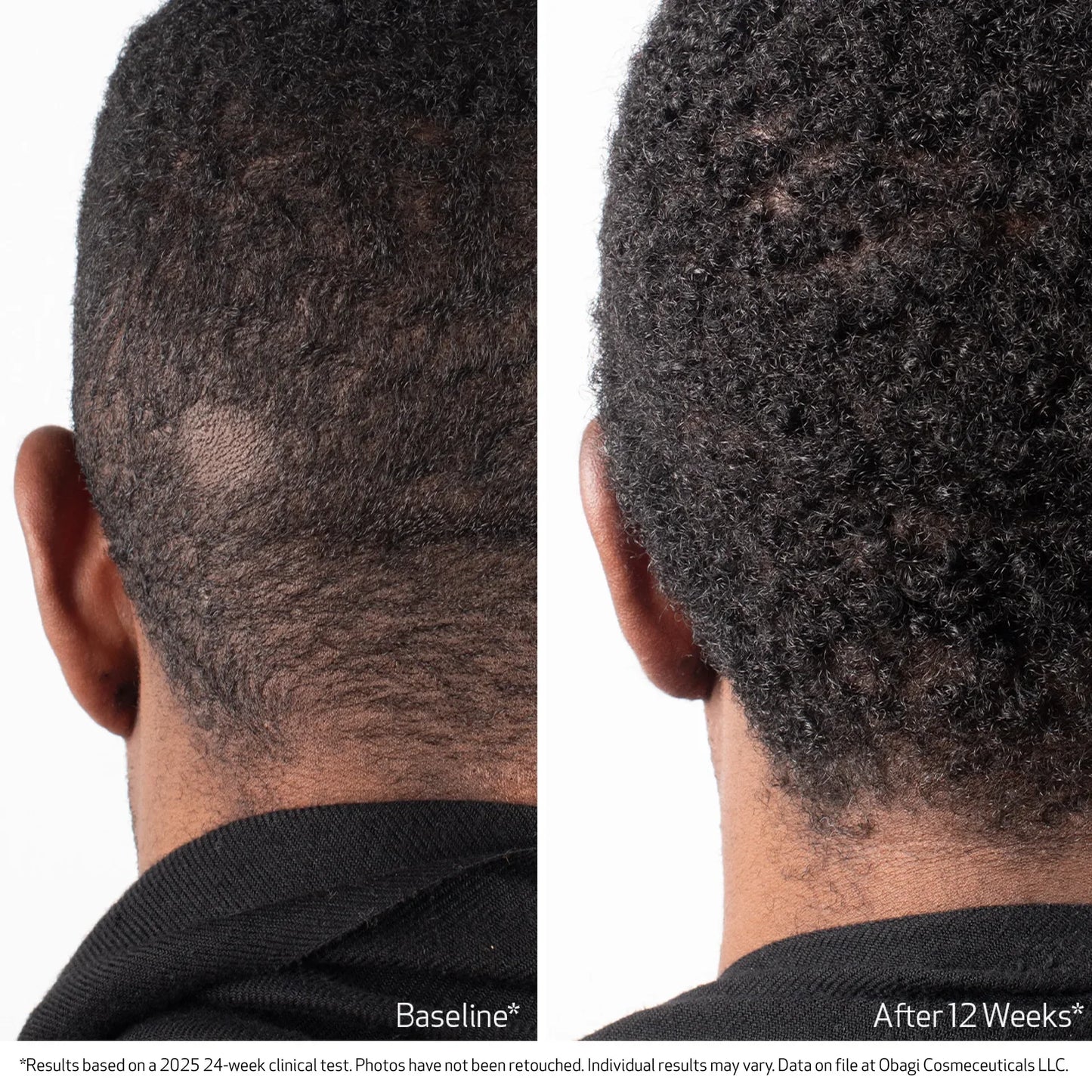 Obagi Nu-Cil Biostim™ Scalp Serum