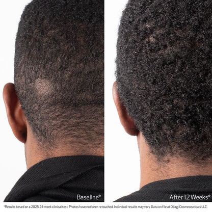Obagi Nu-Cil Biostim™ Scalp Serum