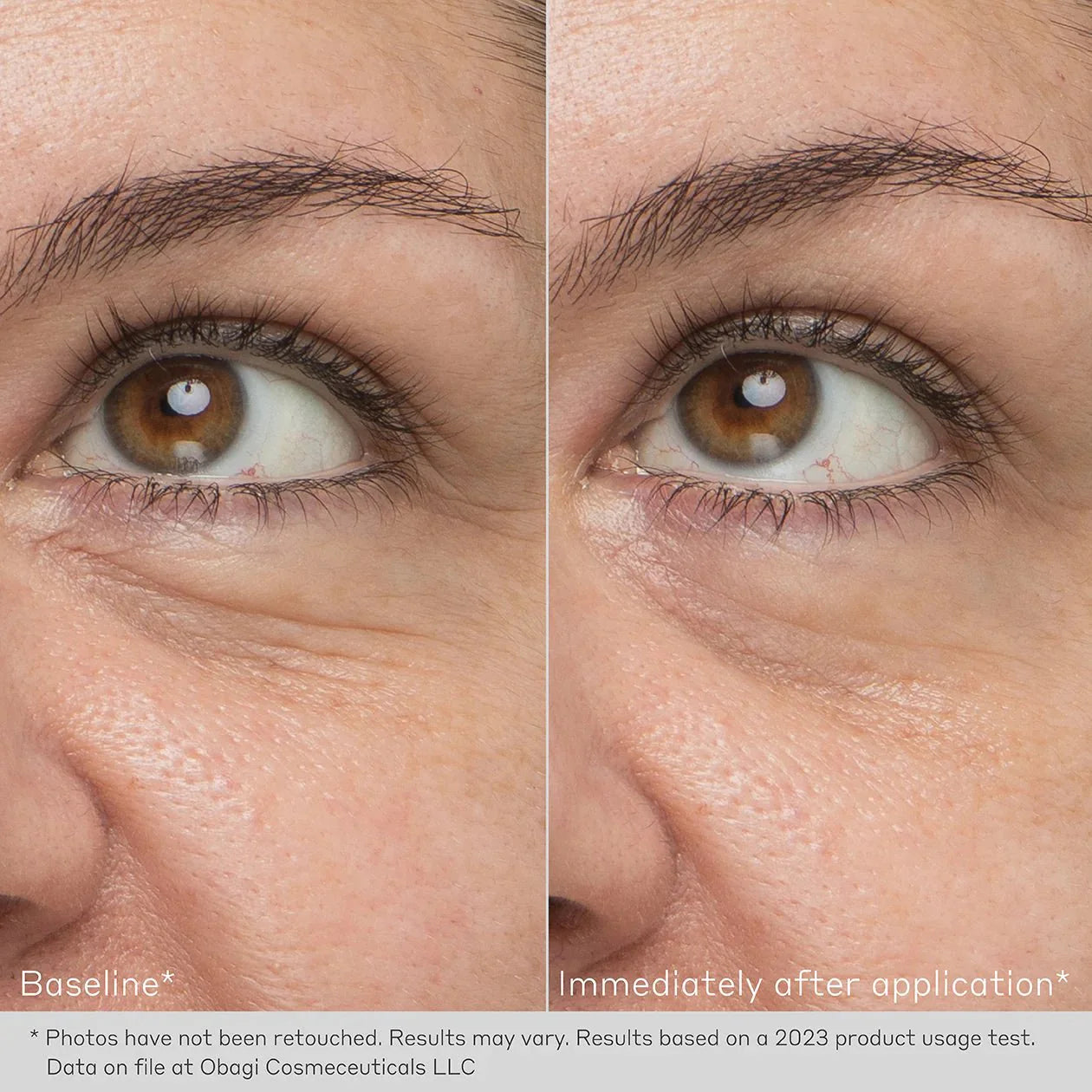 Obagi Daily Hydro-Drops Rejuvenating Eye Gel Cream