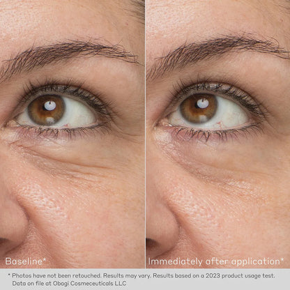Obagi Daily Hydro-Drops Rejuvenating Eye Gel Cream