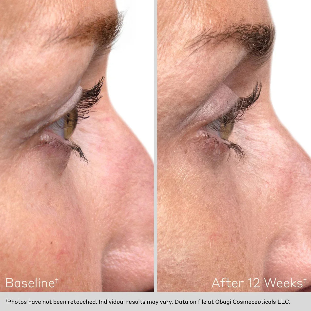 Obagi NU-CIL Eyelash Enhancing Serum