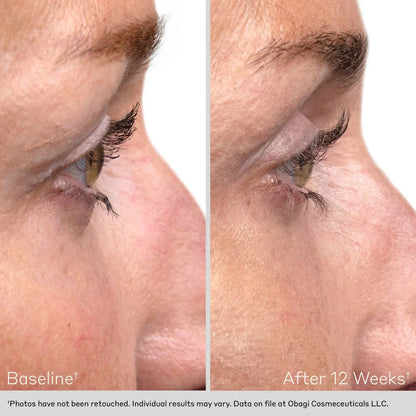 Obagi NU-CIL Eyelash Enhancing Serum