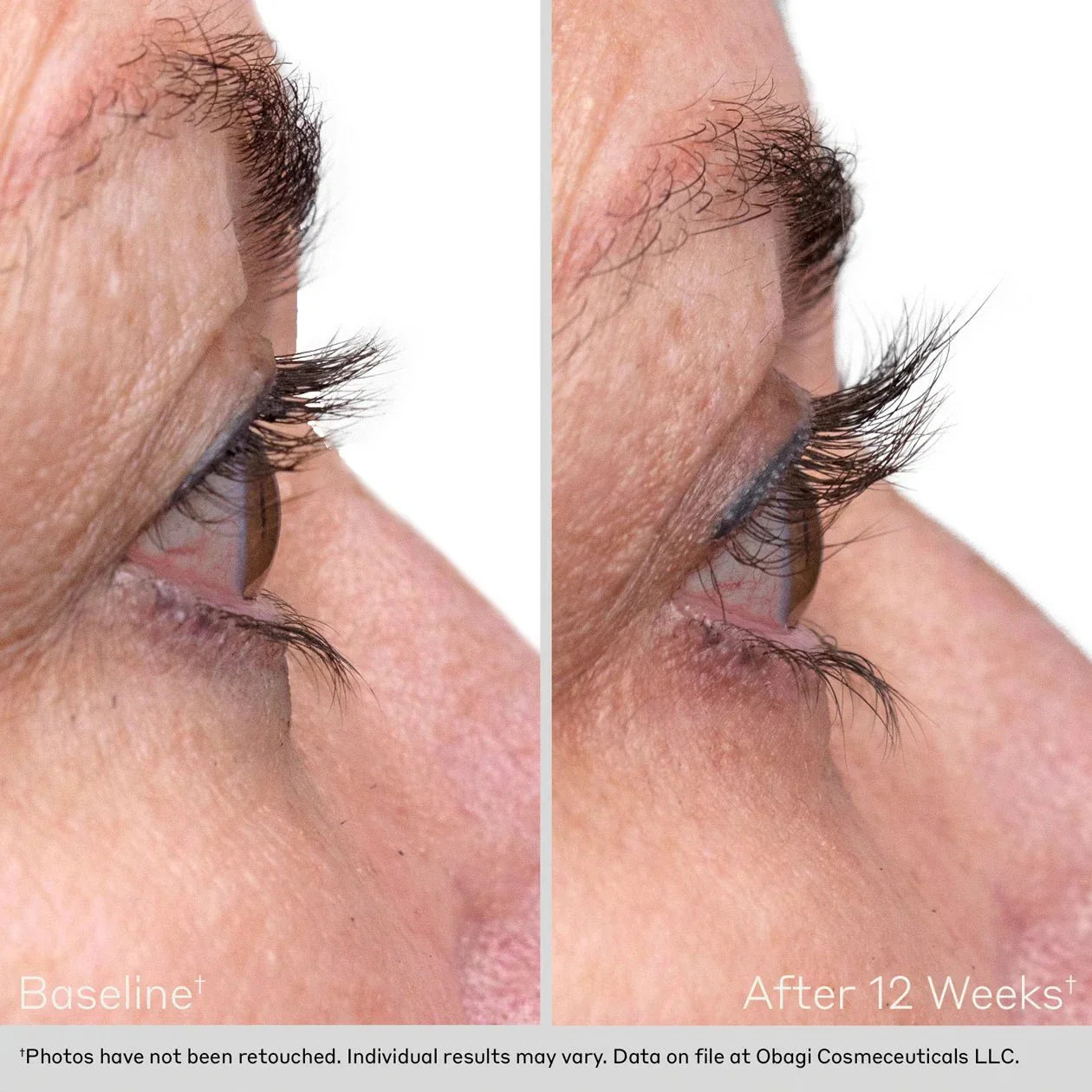 Obagi NU-CIL Eyelash Enhancing Serum