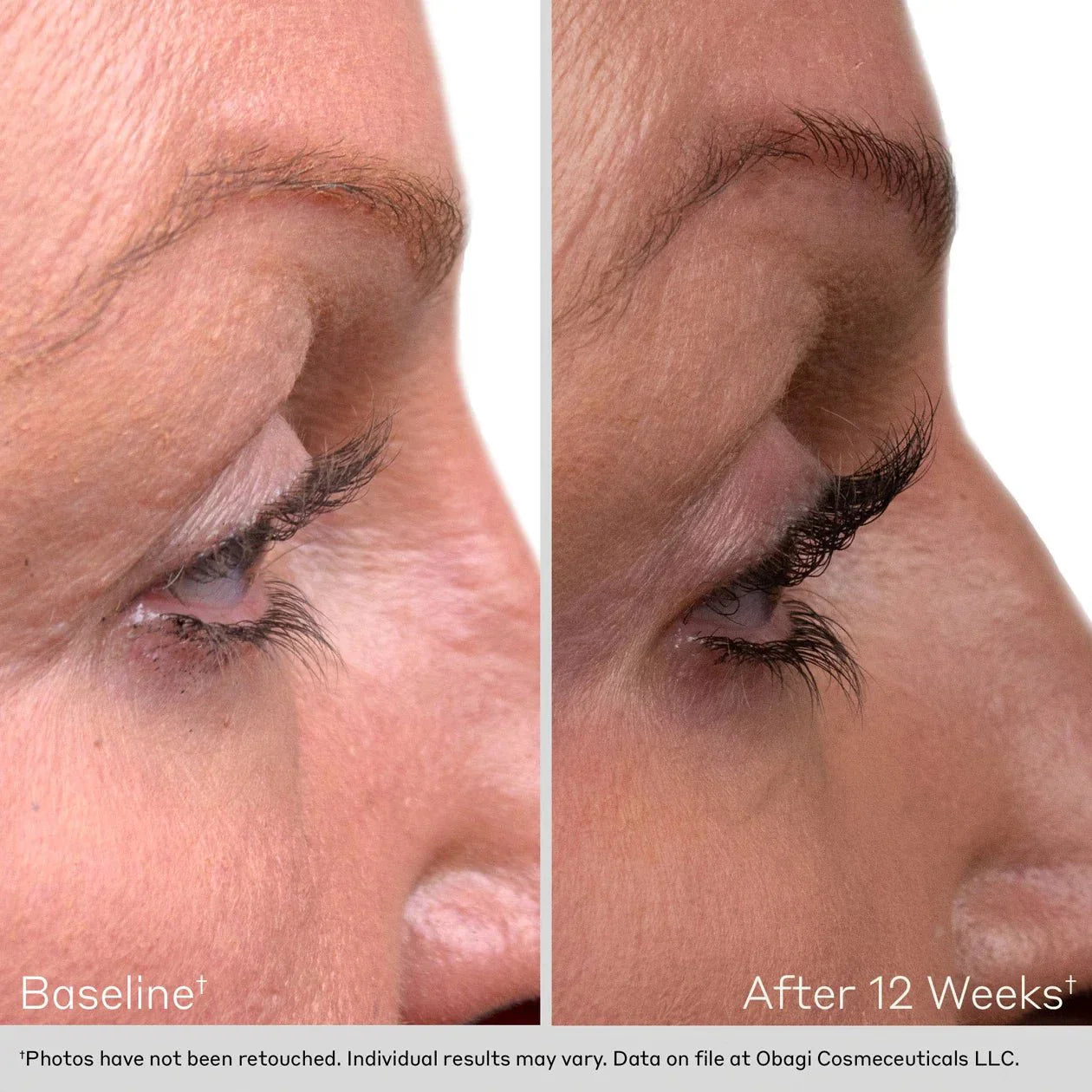 Obagi NU-CIL Eyelash Enhancing Serum